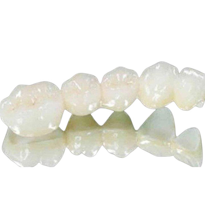 Transparente dental todas as coroas cerâmicas fáceis lustrando a superfície naturalmente brilhante