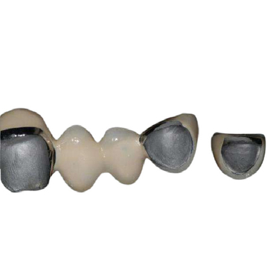 Resistente à corrosão super dos dentes naturais da porcelana da liga de Chrome do cobalto