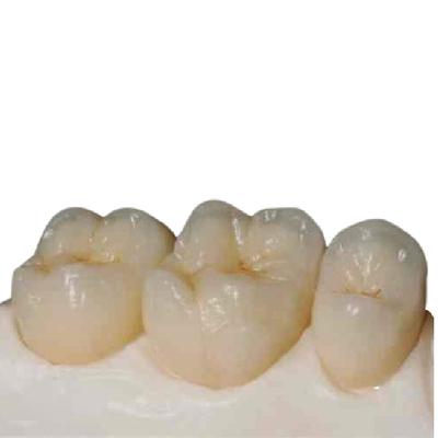 Precisão cerâmica Digital dos dentes da zircônia de grande resistência manufaturado