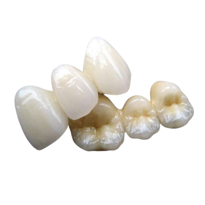 Estabilidade forte do dente da coroa da ponte da porcelana nenhuns sensação do corpo estrangeiro