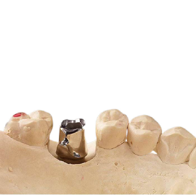 O limite puro de trituração do titânio do processo implanta bom Biocompatibility durável