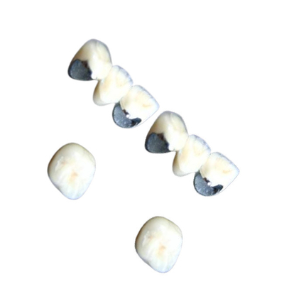 Dentes dentais da porcelana de Chrome do cobalto da coroa da porcelana não alérgica resistentes à corrosão