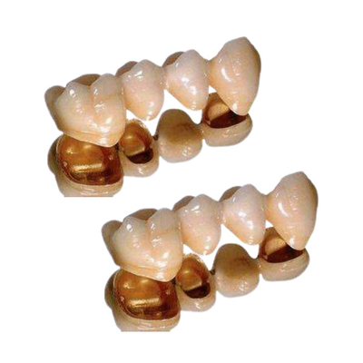 Ductilidade excelente da coroa dental da porcelana do paládio resistente à corrosão