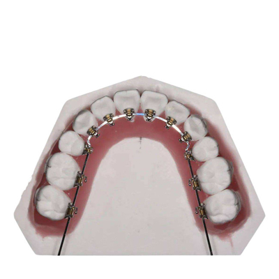 O fio reto fixou dispositivos ortodônticos para o endireitamento dos dentes