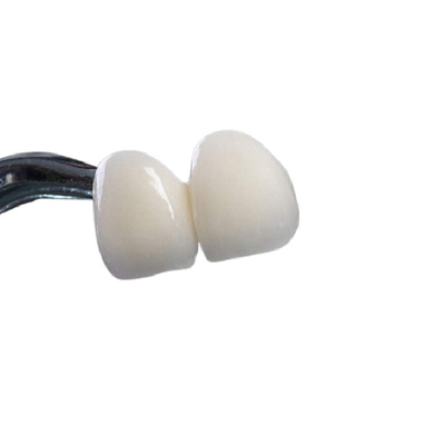 Coroa dental da boa zircônia de Biocompatibility que irrita não a limpeza fácil
