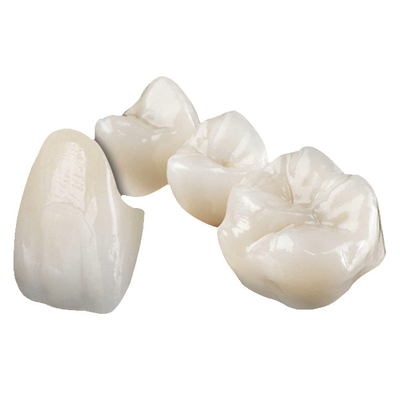 Coroa dentária de zircônio: perfeita e de aparência natural