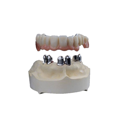 3D dental imprimiu coroas da zircônia veste - Biocompatibility alto resistente