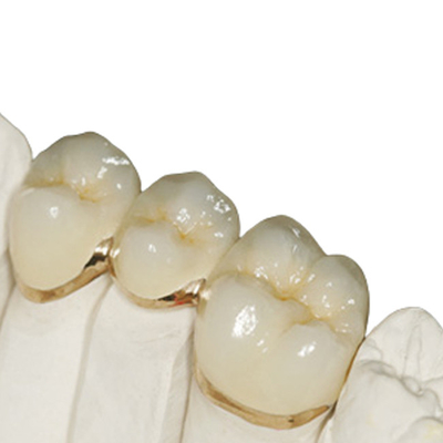 Laboratório de restauração dentária especializado em Zirconia Reparação com ajuste preciso
