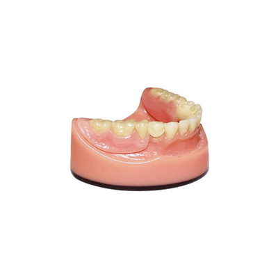 Sistema de varredura Intraoral dental da imagem latente da ponte 3D Digitas do OEM PFM