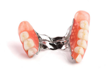 Dentaduras removíveis invisíveis Dentes do siso Restauração de dentes grandes Cobertura de implante temporária