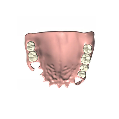 O laboratório dental de mastigação alto CAD/CAM da dentadura da eficiência fixou a dentadura parcial