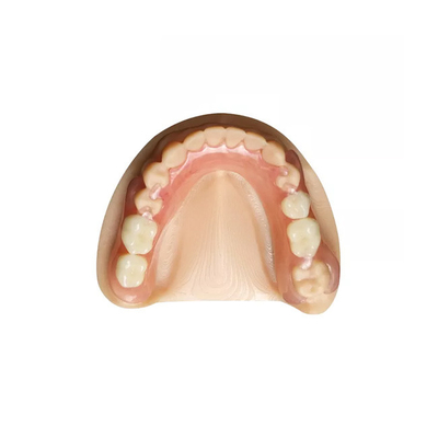 Da dentadura removível dental da coroa da zircônia do OEM laboratório dental profissional
