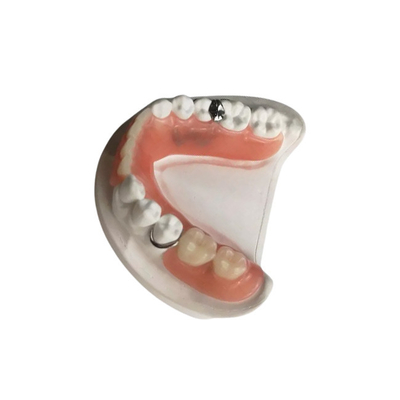 3D imprimiu do controle de qualidade dental da coroa da zircônia dentaduras removíveis feito-à-medida