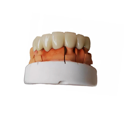 Segurança de alta qualidade de superfície lisa da coroa dental provisória de PFM