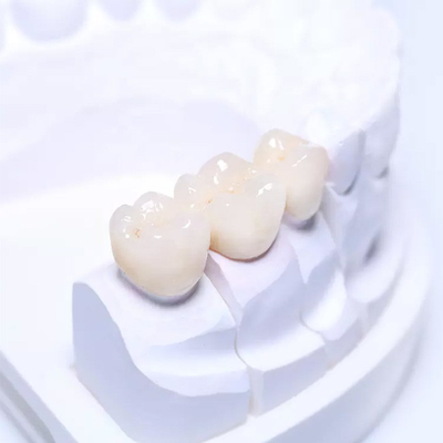 Segurança de alta qualidade da ponte dental parcial removível de superfície lisa das dentaduras PFM