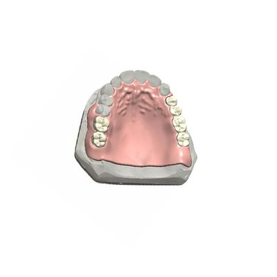 O controle de qualidade dental realístico 3D da coroa da aparência PFM imprimiu modelos dentais