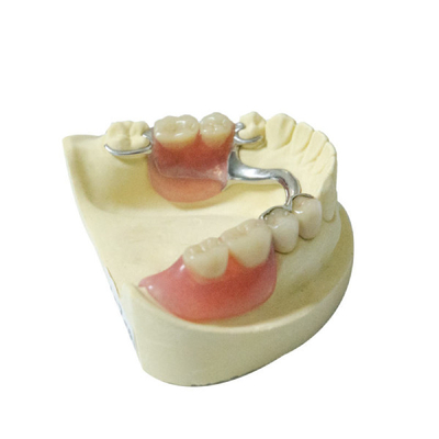 Dentaduras parciais removíveis do laboratório dental saudável da dentadura dos materiais feito-à-medida