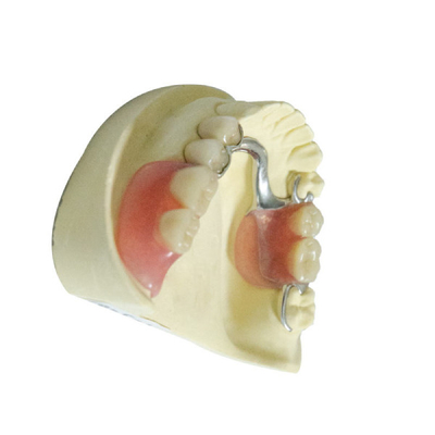 Dentaduras parciais removíveis acrílicas dos produtos dentais profissionais do laboratório