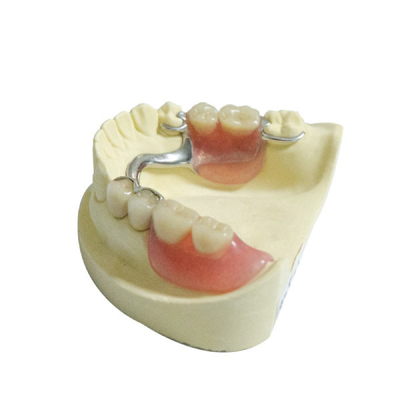 Das substituições dentais dos produtos do laboratório do CE dentaduras parciais removíveis plásticas