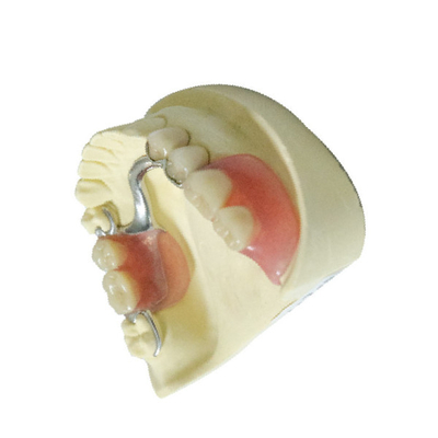 Polímero dental feito-à-medida dos produtos do laboratório dentaduras parciais removíveis