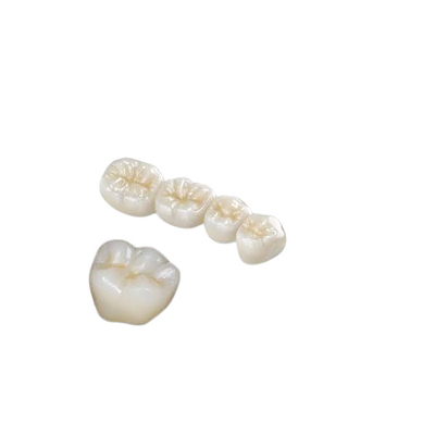 Resistência de corrosão forte Biocompatibility alto da coroa dental do dente da zircônia