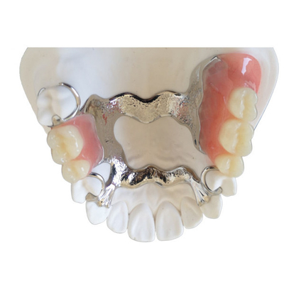 Ponte dental Intermiscibility biológico alto da coroa da impressora PFM do OEM 3D