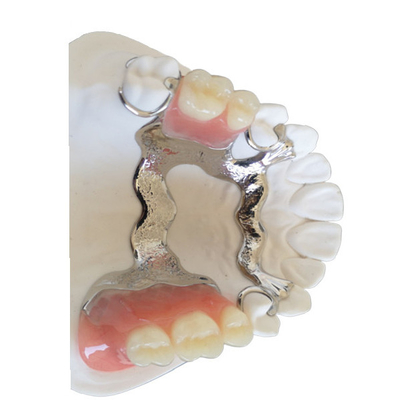 3D que imprime a coroa dental de PFM personalizou Intermiscibility biológico alto