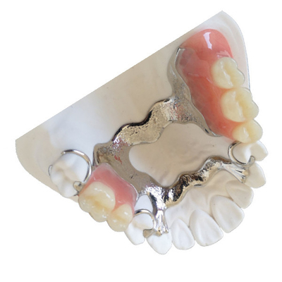 Porcelana dental dental de FDA da coroa do laboratório PFM fundida à coroa do metal