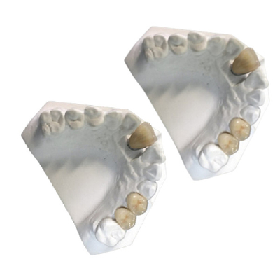 Coroa dental da porcelana do Co-Cr PFM da coroa da porcelana do ouro amarelo do laboratório