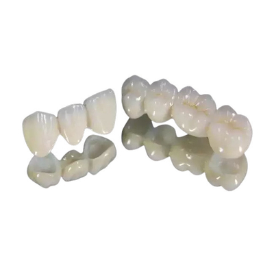 O bom dobro dental dos dentes da ponte da coroa da resistência de desgaste terminou coroa fixa da ponte