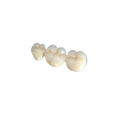 Da cor dental do dente da mudança da ponte da coroa da higiene oral boa estabilidade