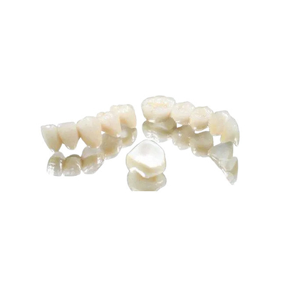 Do metal dental da ponte da coroa da experiência o dobro completo da coroa terminou coroa fixa da ponte
