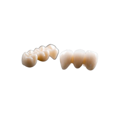O dobro terminou os dentes fixos da ponte da coroa da liga de ouro da coroa da ponte