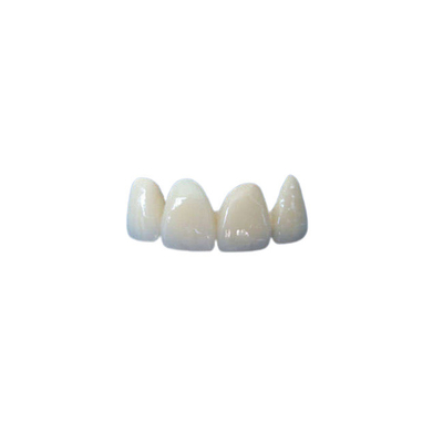 A coroa dental cerâmica da boa estabilidade coube corretamente a higiene oral de alta qualidade