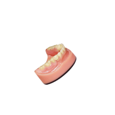 Sistema de varredura Intraoral dental dental da imagem latente da ponte 3D Digitas do laboratório PFM da dentadura
