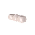 Da porcelana dental da coroa da porcelana ponte dental para resultados devista