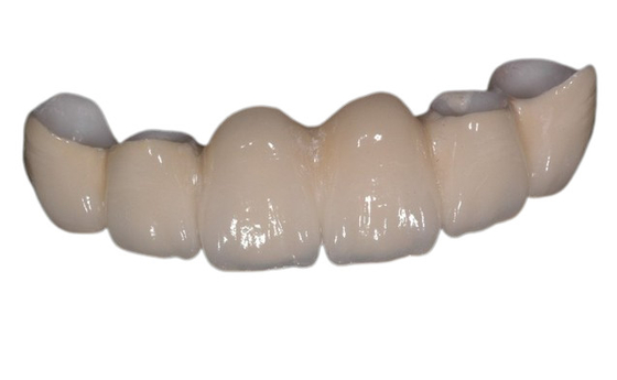 Coroa dental da porcelana de superfície lisa para restaurar a mastigação da boa estabilidade do poder