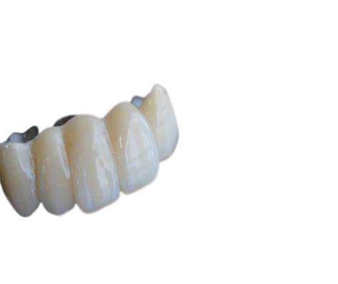 Pontes realísticas da aparência e cor natural da estabilidade forte dental das coroas