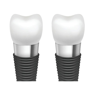 Aumentando a estética oral com as barras do implante dental