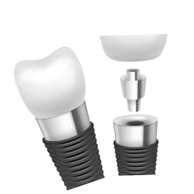 O implante dental barra a inovação material para o desempenho superior