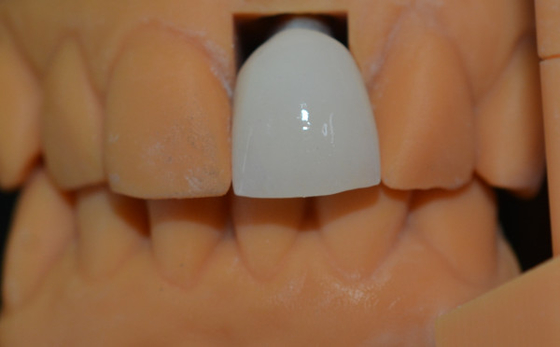 Melhore a eficiência do seu laboratório com um laboratório de próteses dentárias de alta durabilidade