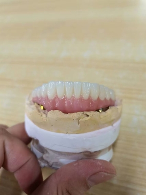 Elevando padrões nosso controle de qualidade da coroa do implante dental
