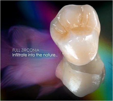 Onlay dental do embutimento do folheado da coroa da zircônia Todo-cerâmica de FDA 3014652903