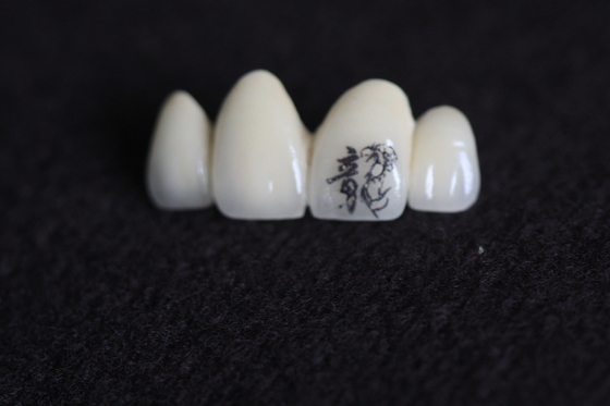 PFM Dental Crown Image Personalização com padrões personalizados personalizados