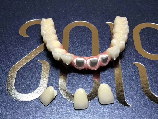 A coroa Biocompatible de superfície lisa do dente da zircônia fácil mantém