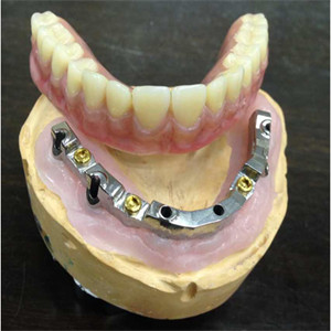 Implante dental da segurança do laboratório da dentadura inter biológica alta da miscibilidade