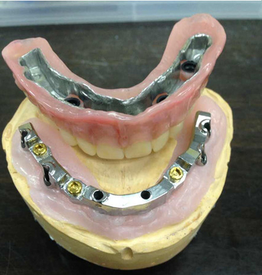 Implante dental da segurança do laboratório da dentadura inter biológica alta da miscibilidade