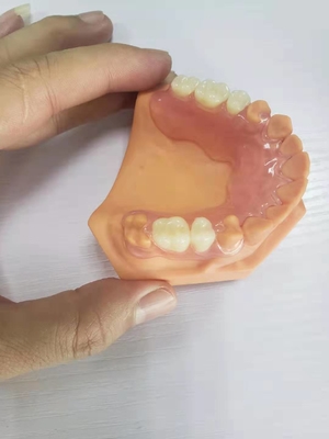 3D imprimiu dentaduras para os laboratórios dentais baseados em dados de Digitas