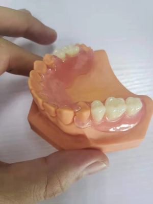 3D imprimiu dentaduras para os laboratórios dentais baseados em dados de Digitas