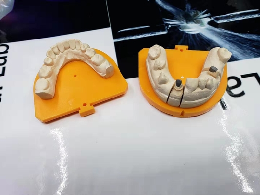 Coroa cerâmica dental da coroa PFM da porcelana de grande resistência do ouro amarelo